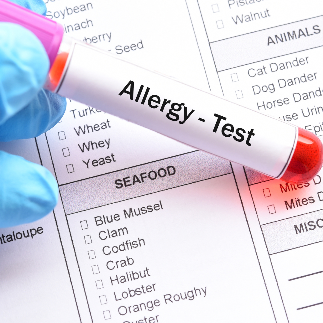 Allergy Panels