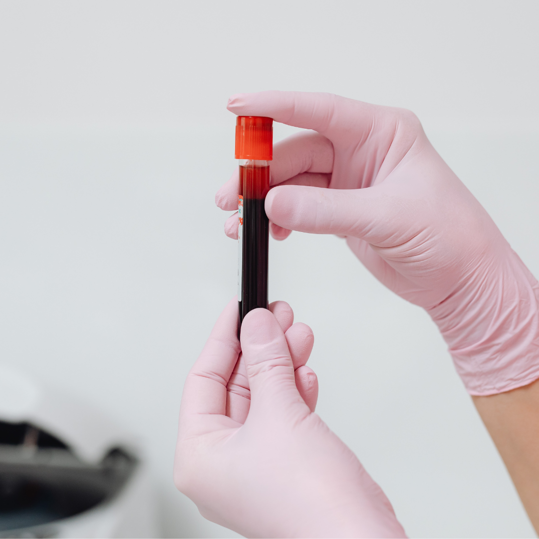 Anemia