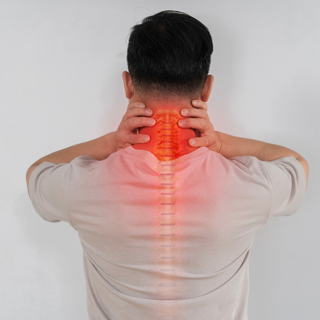 Cervical Spondylosis