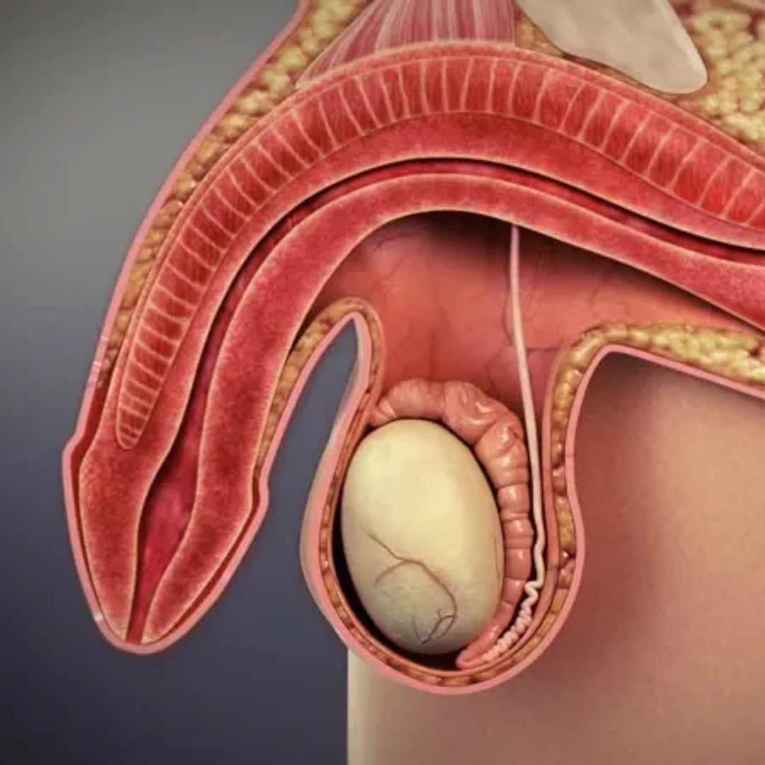 Erectile Dysfunction