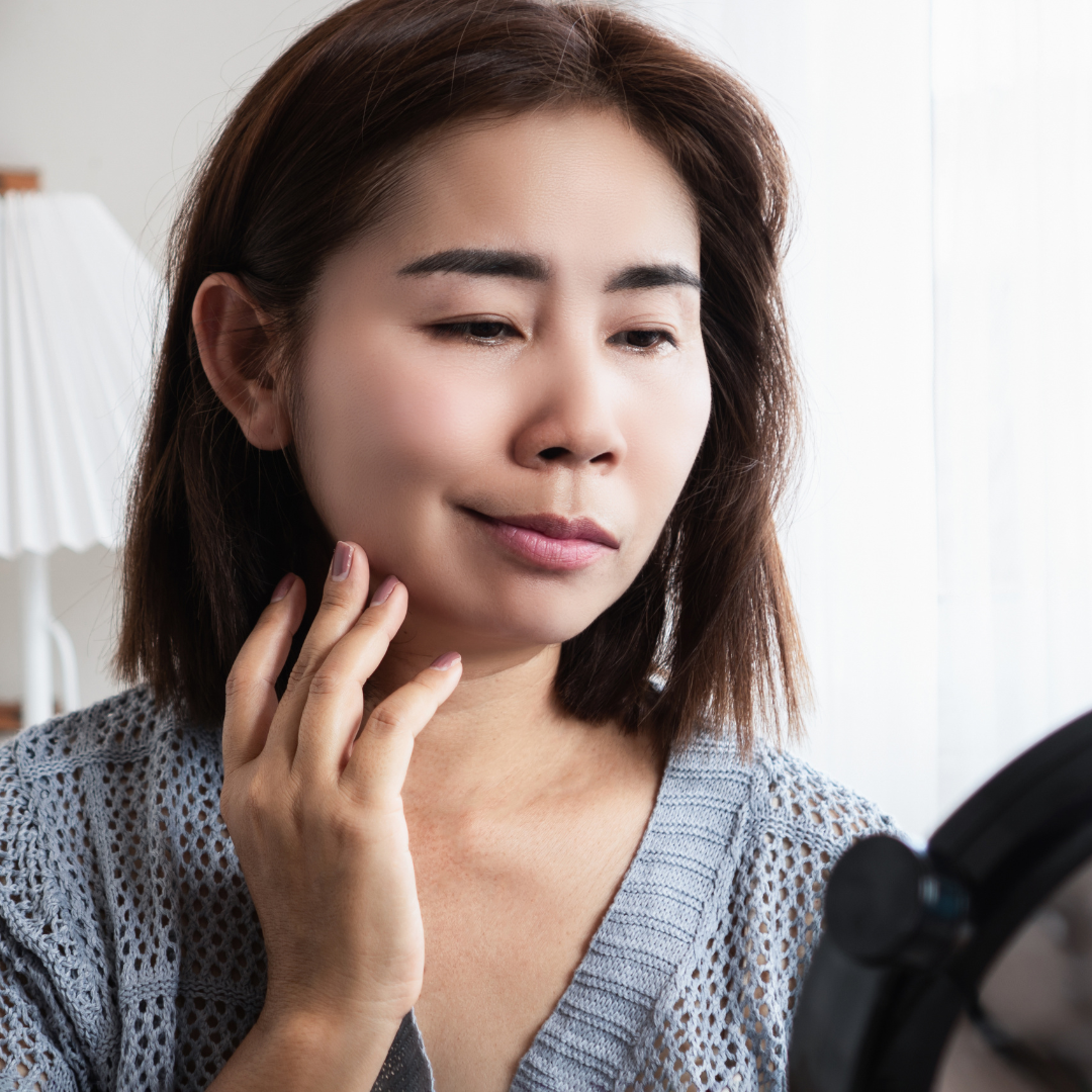Facial Palsy (Bell's Palsy)