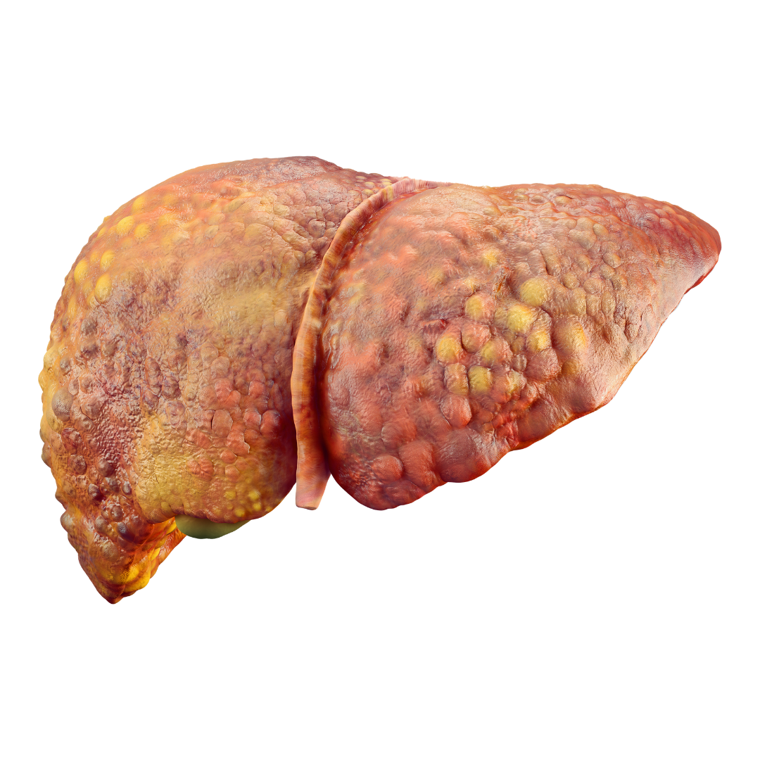 Liver Disease