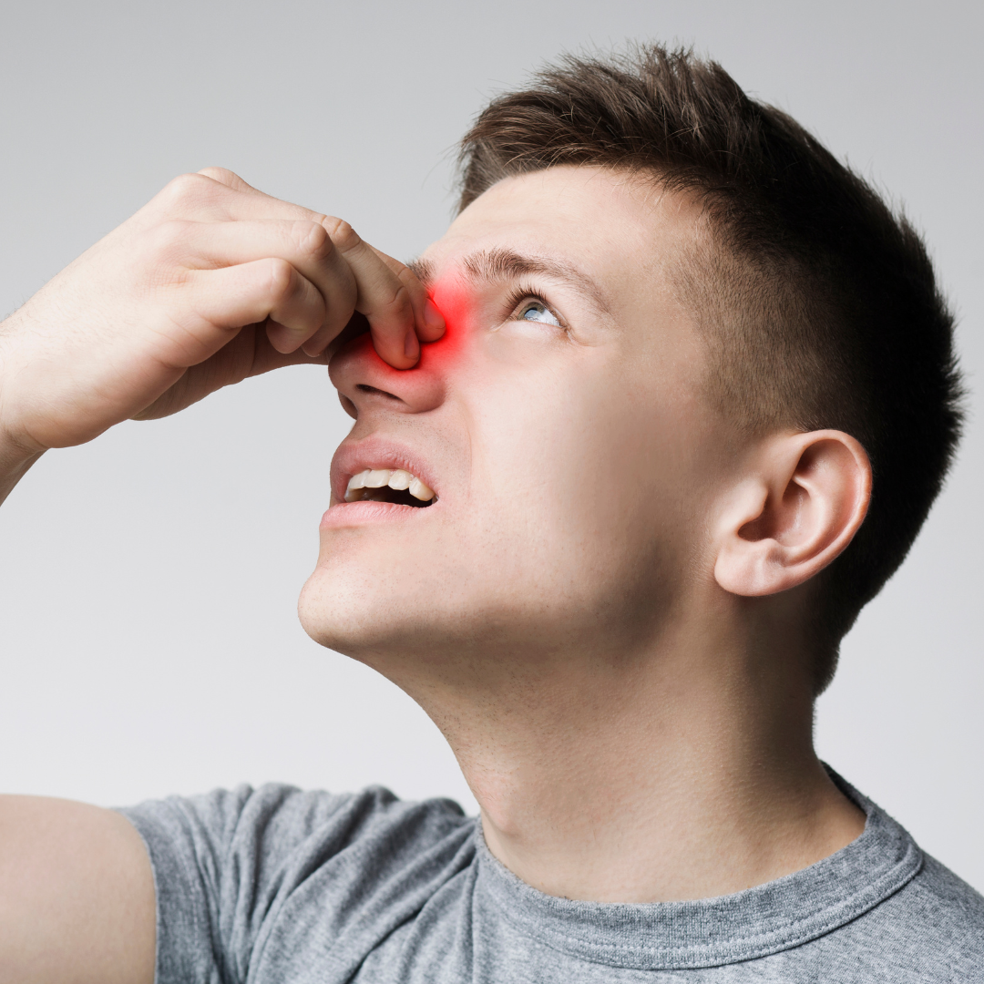 Nasal Polyps
