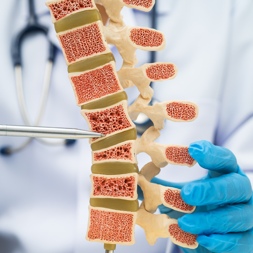 Osteoporosis