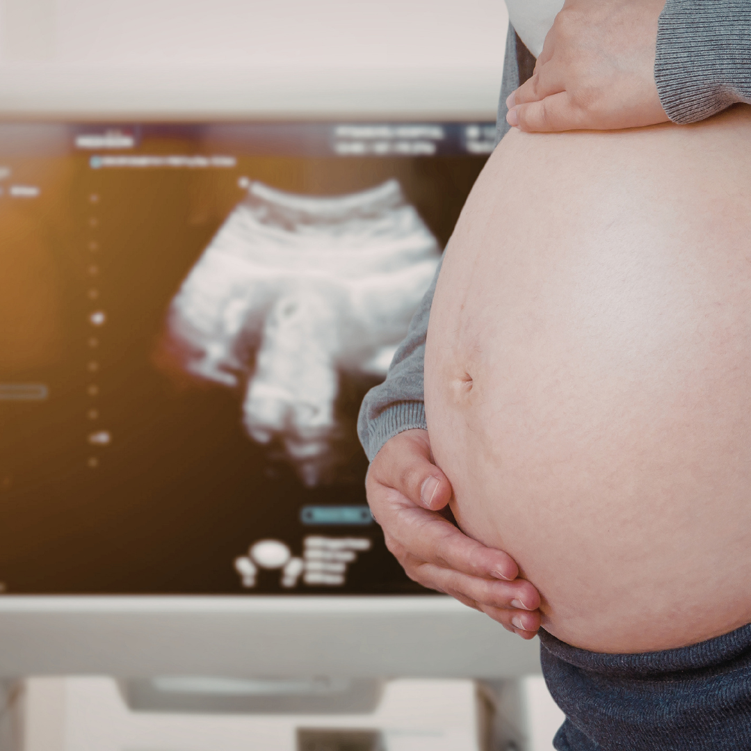 Pregnancy Scans