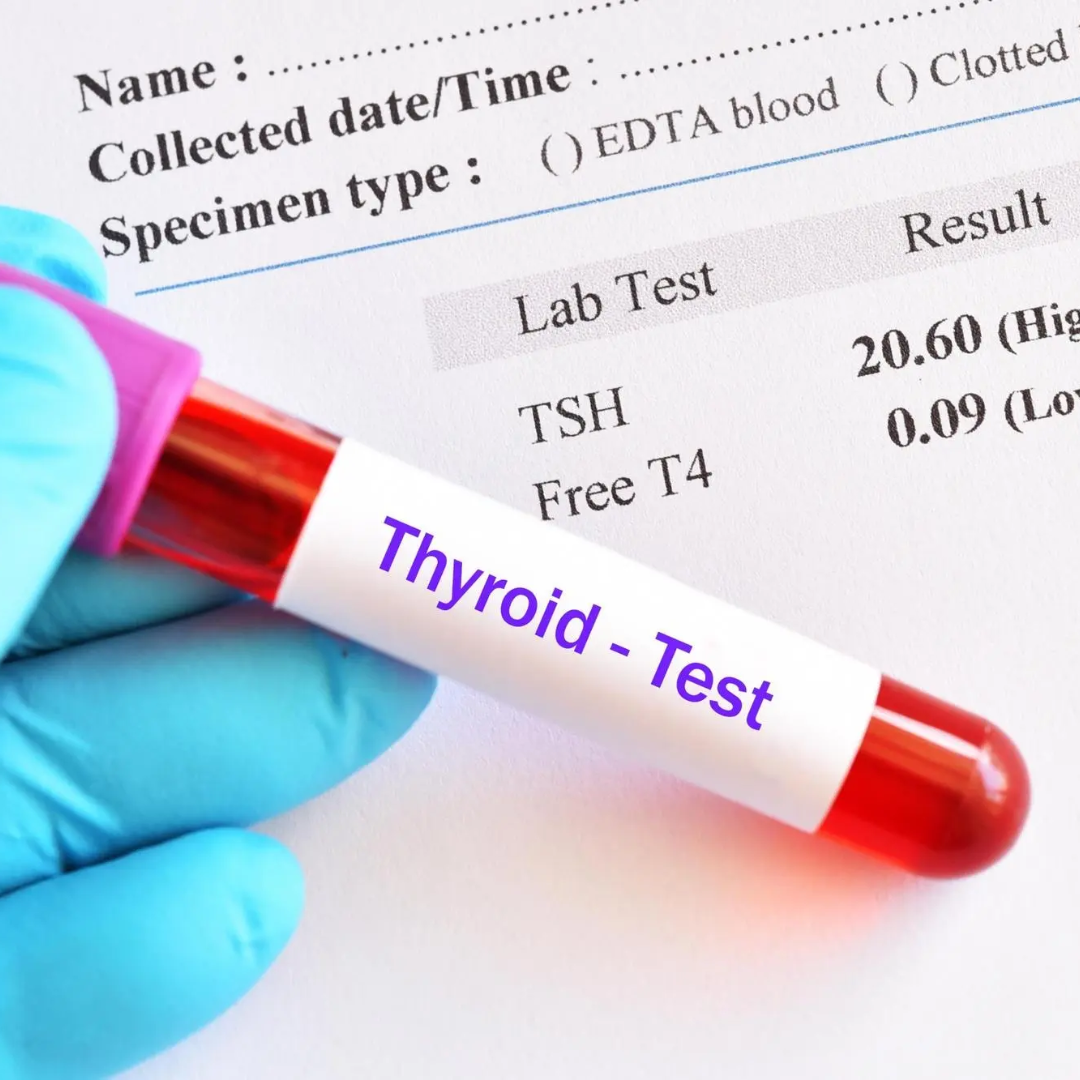 Thyroid Profile